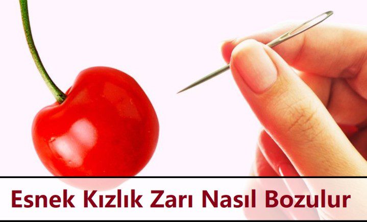 Esnek Kızlık Zarı Nasıl Bozulur