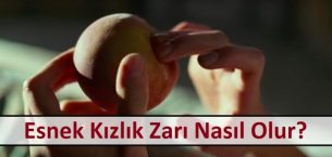 Esnek Kızlık Zarı Nasıl Olur