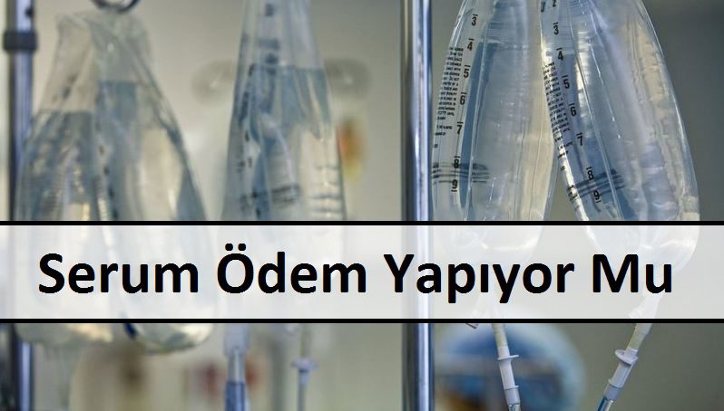 Serum Ödem Yapıyor Mu