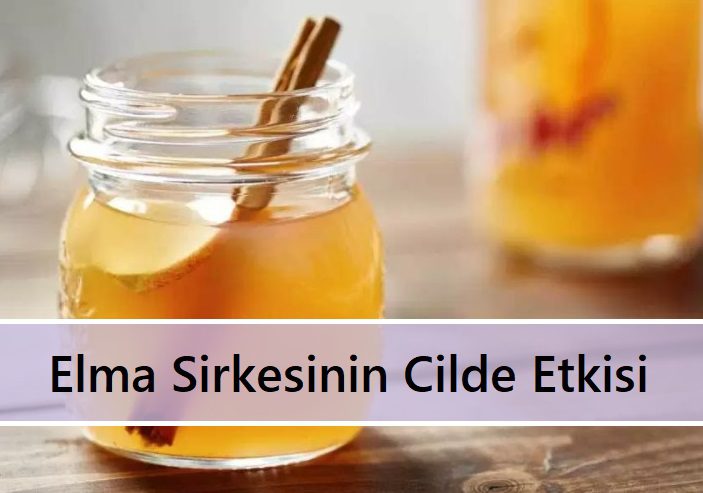 Elma Sirkesinin Cilde Etkisi